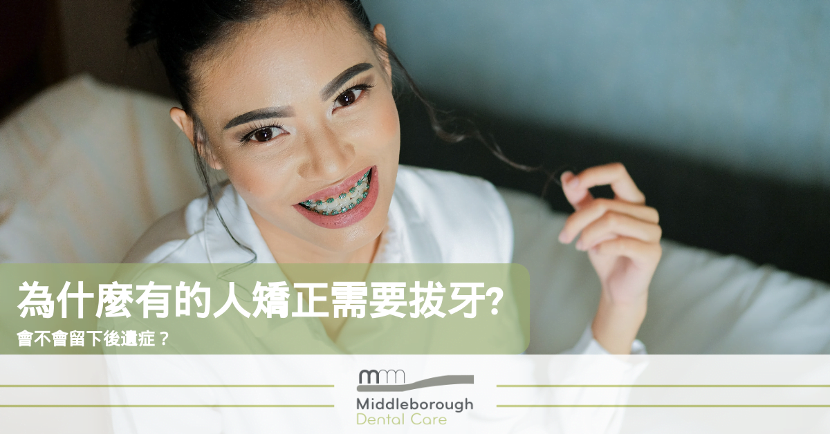 為什麼有的人矯正需要拔牙 會不會留下後遺症 Middleborough Dental Care 為什麼有的人矯正需要拔牙 會不會留下後遺症 Middleborough Dental Care