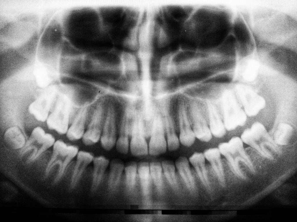 Latest X-ray Technology for Dental