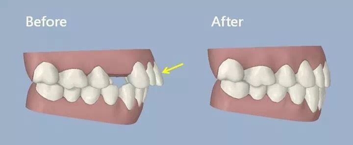 Before and After Clear Dental Care