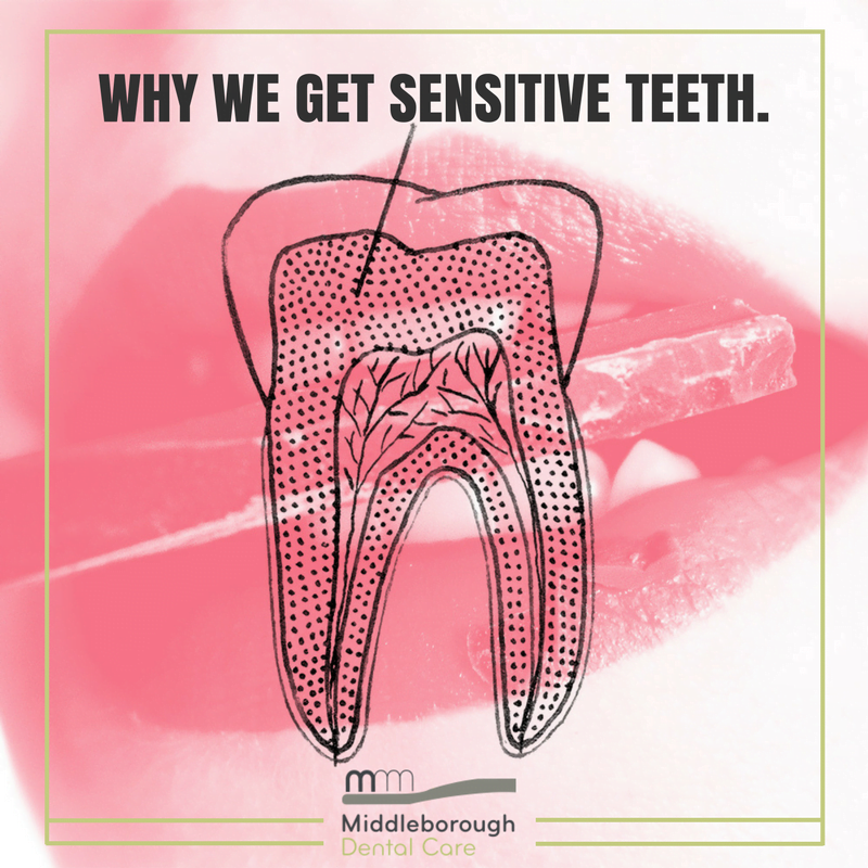 Guidance How to get sensitive teeth