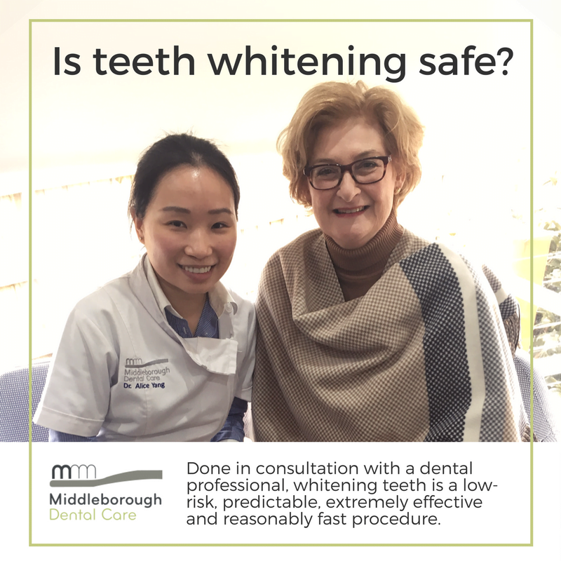 Teeth Whitening Question and Ans