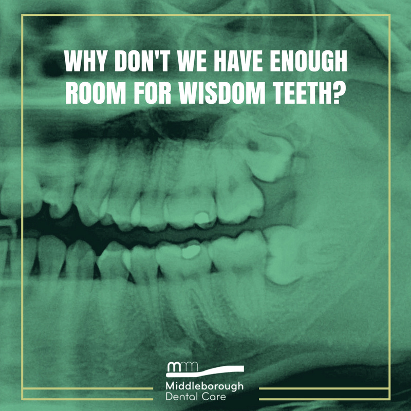 Worried about wisdom teeth