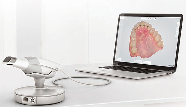 TRIOS Intraoral Scanner